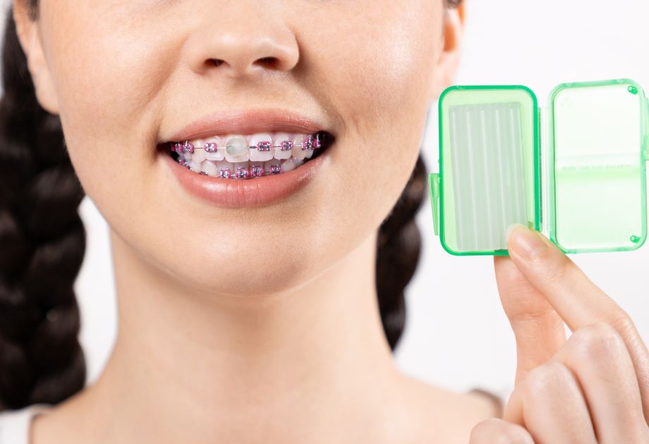 girl shows retainer case and smiles